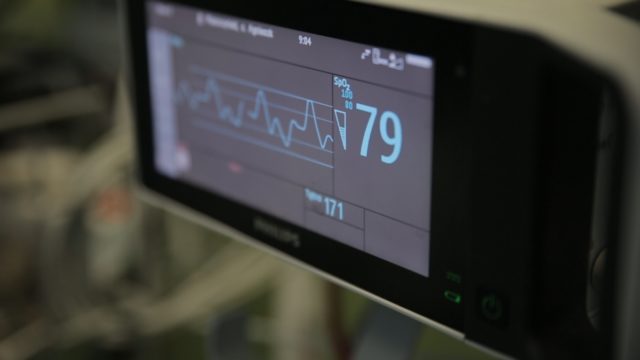 pomiar-ekg-zdj1-1